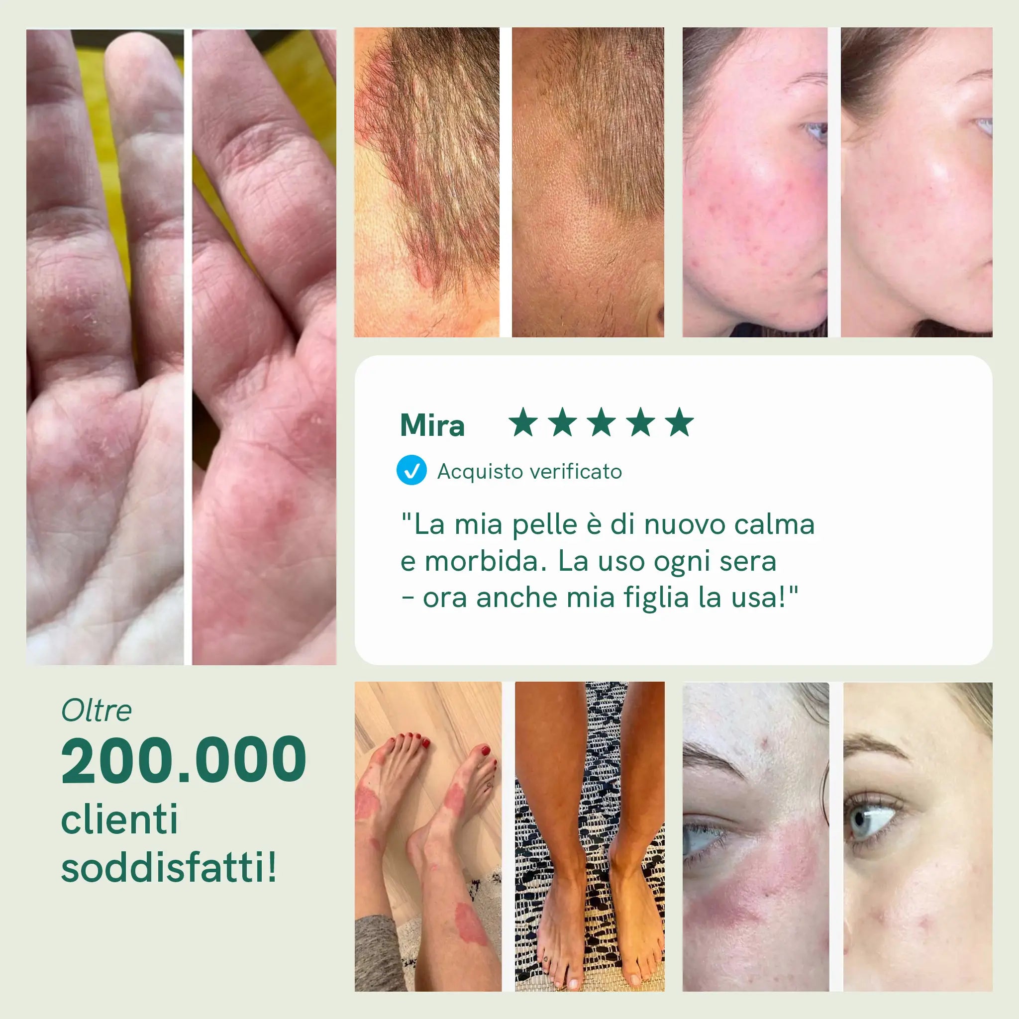 Nordic Oil Nordic Cosmetics Crema CBD 250 mg Pelle Secca